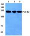 Phospholipase C Beta 2 antibody, A05927, Boster Biological Technology, Western Blot image 