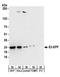 Ubiquitin-conjugating enzyme E2 S antibody, A304-105A, Bethyl Labs, Western Blot image 