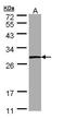 Phosphoserine Phosphatase antibody, TA308185, Origene, Western Blot image 