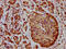 Protein THEMIS2 antibody, CSB-PA735984LA01HU, Cusabio, Immunohistochemistry paraffin image 