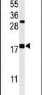 Shadow Of Prion Protein antibody, PA5-24688, Invitrogen Antibodies, Western Blot image 