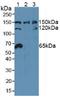 Nucleoporin 155 antibody, LS-C374070, Lifespan Biosciences, Western Blot image 