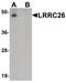 Leucine Rich Repeat Containing 26 antibody, PA5-38058, Invitrogen Antibodies, Western Blot image 