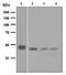 Tumor Susceptibility 101 antibody, ab125011, Abcam, Western Blot image 