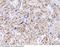Galectin 1 antibody, 10290-MM01, Sino Biological, Immunohistochemistry frozen image 