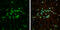 Growth Differentiation Factor 10 antibody, GTX118039, GeneTex, Immunofluorescence image 
