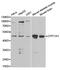 Cytochrome P450 Family 11 Subfamily A Member 1 antibody, PA5-37359, Invitrogen Antibodies, Western Blot image 