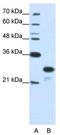Acidic Nuclear Phosphoprotein 32 Family Member A antibody, TA345683, Origene, Western Blot image 