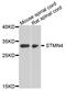 Stathmin 4 antibody, abx007299, Abbexa, Western Blot image 