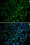SS-A antibody, LS-C748591, Lifespan Biosciences, Immunofluorescence image 