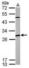 ANP32A antibody, GTX115933, GeneTex, Western Blot image 