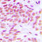 GATA Binding Protein 1 antibody, LS-C352235, Lifespan Biosciences, Immunohistochemistry paraffin image 