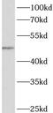 Actin-like protein 7A antibody, FNab00119, FineTest, Western Blot image 