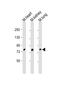 Bromodomain Containing 7 antibody, PA5-49379, Invitrogen Antibodies, Western Blot image 