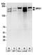 SWI/SNF Related, Matrix Associated, Actin Dependent Regulator Of Chromatin, Subfamily A, Member 4 antibody, A303-877A, Bethyl Labs, Western Blot image 