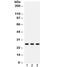 Surfactant Protein A2 antibody, R32279, NSJ Bioreagents, Western Blot image 