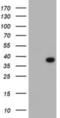 Leucine Rich Repeat Containing 39 antibody, NBP2-02011, Novus Biologicals, Western Blot image 