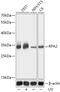 Replication Protein A2 antibody, GTX32844, GeneTex, Western Blot image 