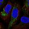 YjeF N-Terminal Domain Containing 3 antibody, HPA060789, Atlas Antibodies, Immunofluorescence image 