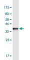 Actin Related Protein T3 antibody, H00084517-M01-100ug, Novus Biologicals, Western Blot image 
