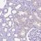 Dehydrogenase/Reductase 2 antibody, HPA069551, Atlas Antibodies, Immunohistochemistry paraffin image 