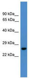 Ubiquitin C-Terminal Hydrolase L3 antibody, TA342563, Origene, Western Blot image 