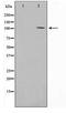 Proteasome 26S Subunit, Non-ATPase 2 antibody, TA347786, Origene, Western Blot image 