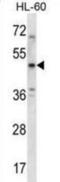 5-Hydroxytryptamine Receptor 1B antibody, abx028152, Abbexa, Western Blot image 