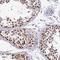 Paired amphipathic helix protein Sin3a antibody, NBP2-38564, Novus Biologicals, Immunohistochemistry frozen image 