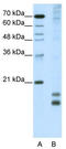 MAF BZIP Transcription Factor F antibody, TA343697, Origene, Western Blot image 