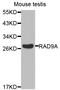 RAD9 Checkpoint Clamp Component A antibody, orb48518, Biorbyt, Western Blot image 
