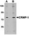 Lymphocyte antigen 6A-2/6E-1 antibody, orb6918, Biorbyt, Western Blot image 