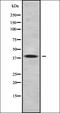 Protein Wnt-11 antibody, orb337835, Biorbyt, Western Blot image 