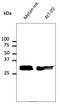 RAB27A, Member RAS Oncogene Family antibody, AB7223-500, Origene, Western Blot image 