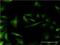 RP2 Activator Of ARL3 GTPase antibody, H00006102-M01, Novus Biologicals, Immunocytochemistry image 