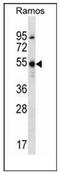 Forkhead Box J2 antibody, AP51712PU-N, Origene, Western Blot image 
