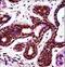 Programmed Cell Death 4 antibody, LS-C163460, Lifespan Biosciences, Immunohistochemistry paraffin image 