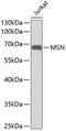 Moesin antibody, 13-301, ProSci, Western Blot image 