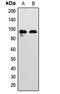 EPH Receptor A7 antibody, abx121998, Abbexa, Western Blot image 