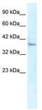 Kelch-like protein 14 antibody, TA337285, Origene, Western Blot image 