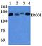 ERCC Excision Repair 6, Chromatin Remodeling Factor antibody, A01519, Boster Biological Technology, Western Blot image 