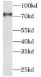 Protein Inhibitor Of Activated STAT 1 antibody, FNab06428, FineTest, Western Blot image 