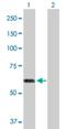1-Aminocyclopropane-1-Carboxylate Synthase Homolog (Inactive) antibody, H00084680-D01P, Novus Biologicals, Western Blot image 