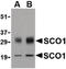 SCO Cytochrome C Oxidase Assembly Protein 1 antibody, LS-B547, Lifespan Biosciences, Western Blot image 