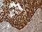 ATP Binding Cassette Subfamily F Member 2 antibody, M10873, Boster Biological Technology, Immunohistochemistry paraffin image 