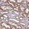 Coiled-coil domain-containing protein 106 antibody, HPA043219, Atlas Antibodies, Immunohistochemistry paraffin image 