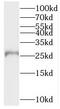 Biphenyl Hydrolase Like antibody, FNab00935, FineTest, Western Blot image 