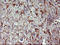 Phospholipid Phosphatase 1 antibody, M11509, Boster Biological Technology, Immunohistochemistry paraffin image 