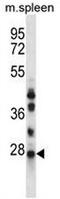 N-Ribosyldihydronicotinamide:Quinone Reductase 2 antibody, AP52927PU-N, Origene, Western Blot image 