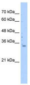 Mitochondrial Ribosomal Protein S15 antibody, TA333635, Origene, Western Blot image 